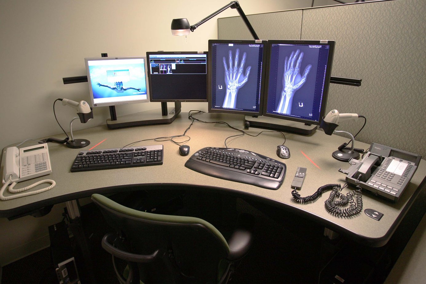 Xybix Desks for Radiology Imaging Desks